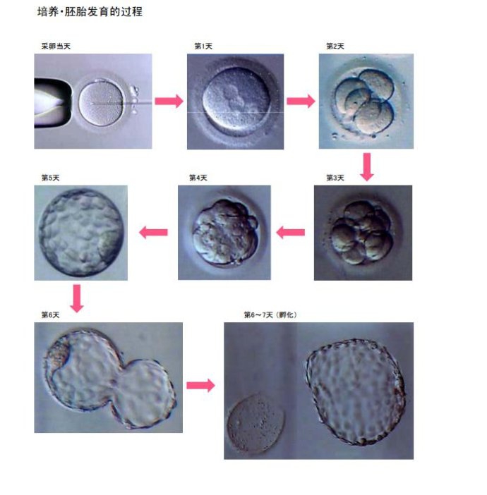 35岁后供卵做公立代生试管成功率是多少泰国供卵做试管能怀双胞胎吗
