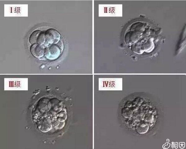 供卵生子自怀试管的成功率有多少