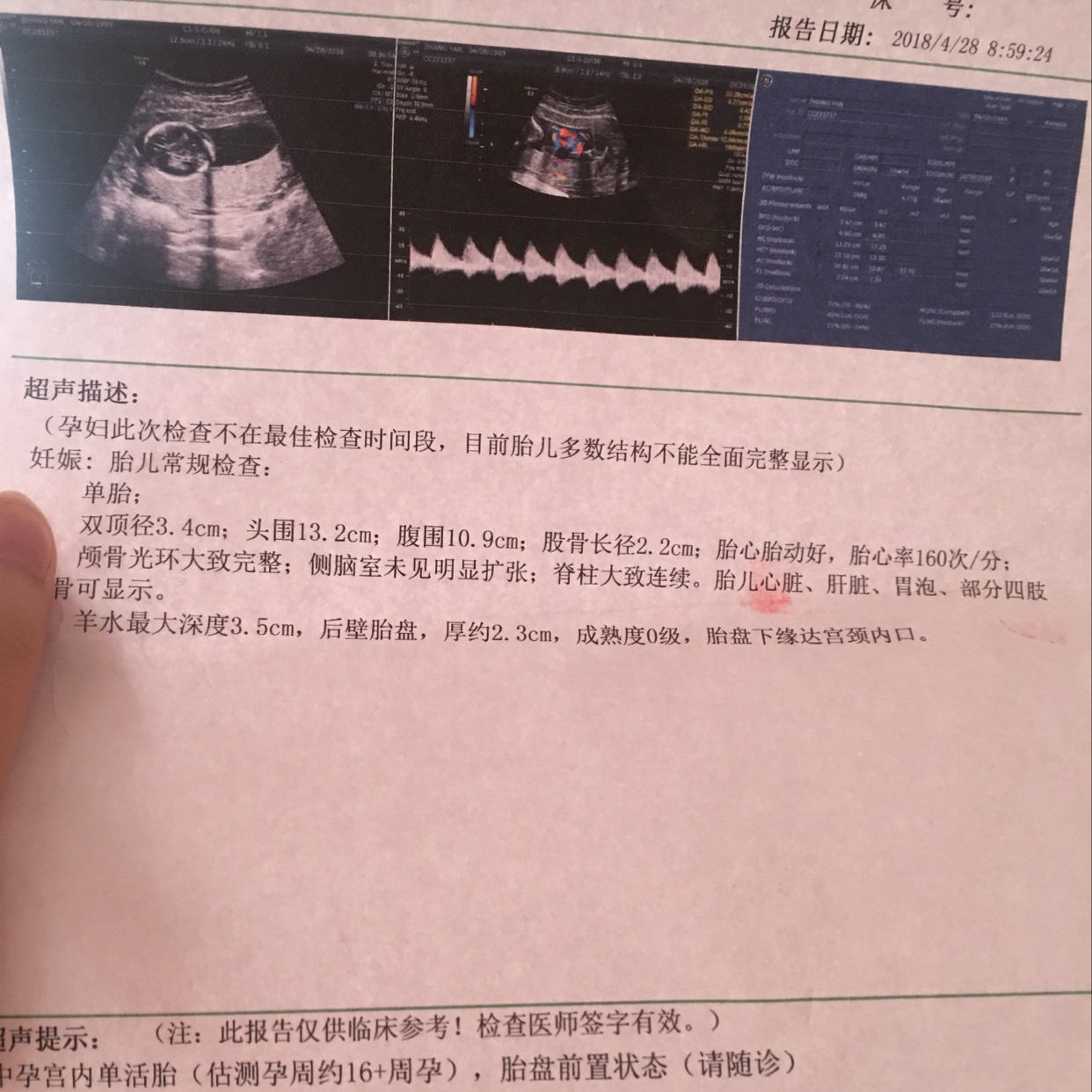 借卵试管婴儿需不需要男生