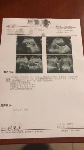 国内代怀生子费用