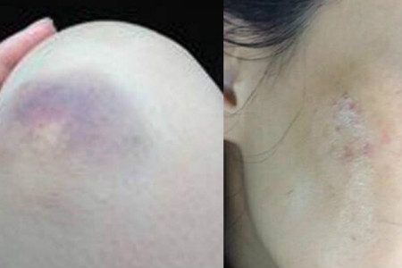 黄冈试管助孕中介