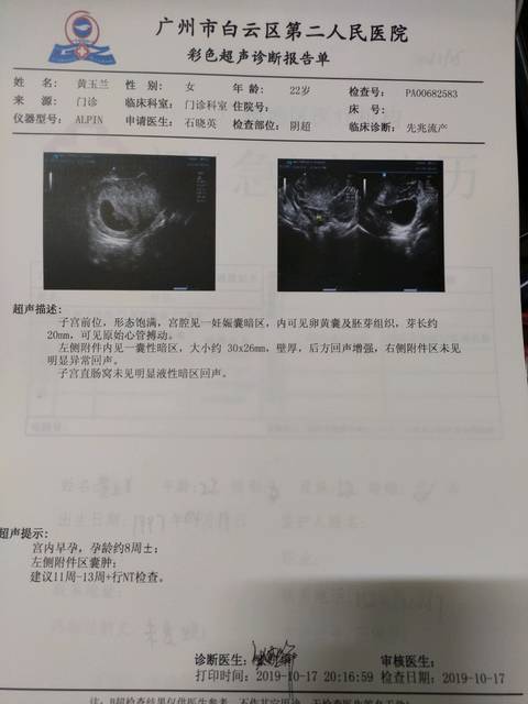 齐鲁医院做试管的流程