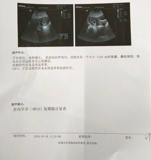 黄冈医院代生男孩子医院步骤？成功率讲解!和优孕行一起看!