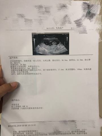 冻卵过程需要多少时间（需要多少钱？）