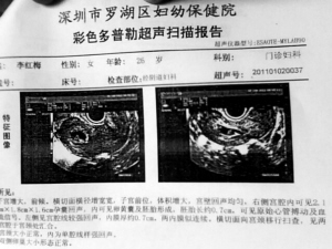 湖北黄冈包生代怀男宝儿子补贴政策