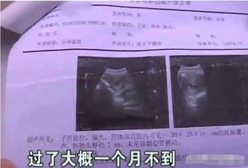 男性精子活力检测出为0怎么办,找出原因才是治疗关键