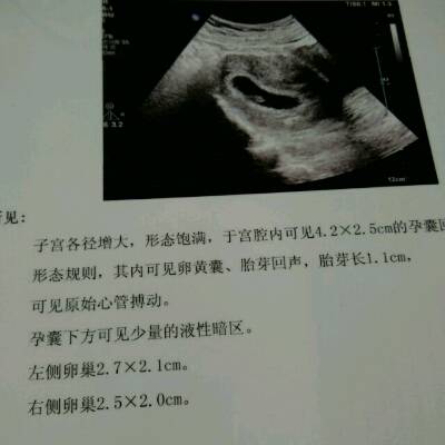 男性精子活力检测出为0怎么办,找出原因才是治疗关键