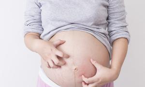 第三代供卵包男孩多少钱多少费用如张预防男性少精症