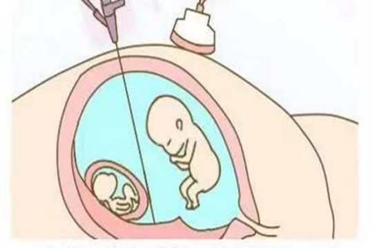 什么是合法供卵机构技术（单胎和双胞胎是一样的吗？）